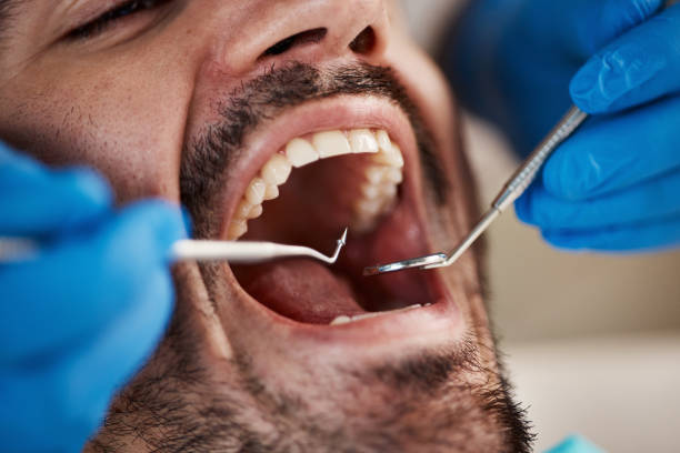 Best Broken or Cracked Tooth Emergency Dentist in Barre, VT