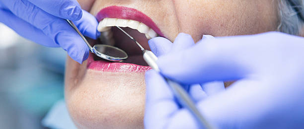 Best Emergency Root Canal Treatment in Barre, VT