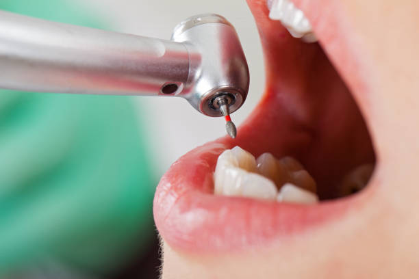 Best Urgent Dental Care for Toothache in Barre, VT